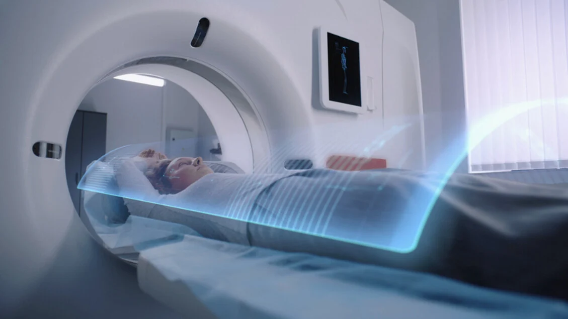 BrainIAC: a IA que lê a idade do cérebro e sinaliza o risco de Alzheimer a partir da ressonância