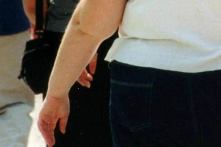 Estudo aponta que 1 a cada 10 mortes por infecções está ligada à obesidade