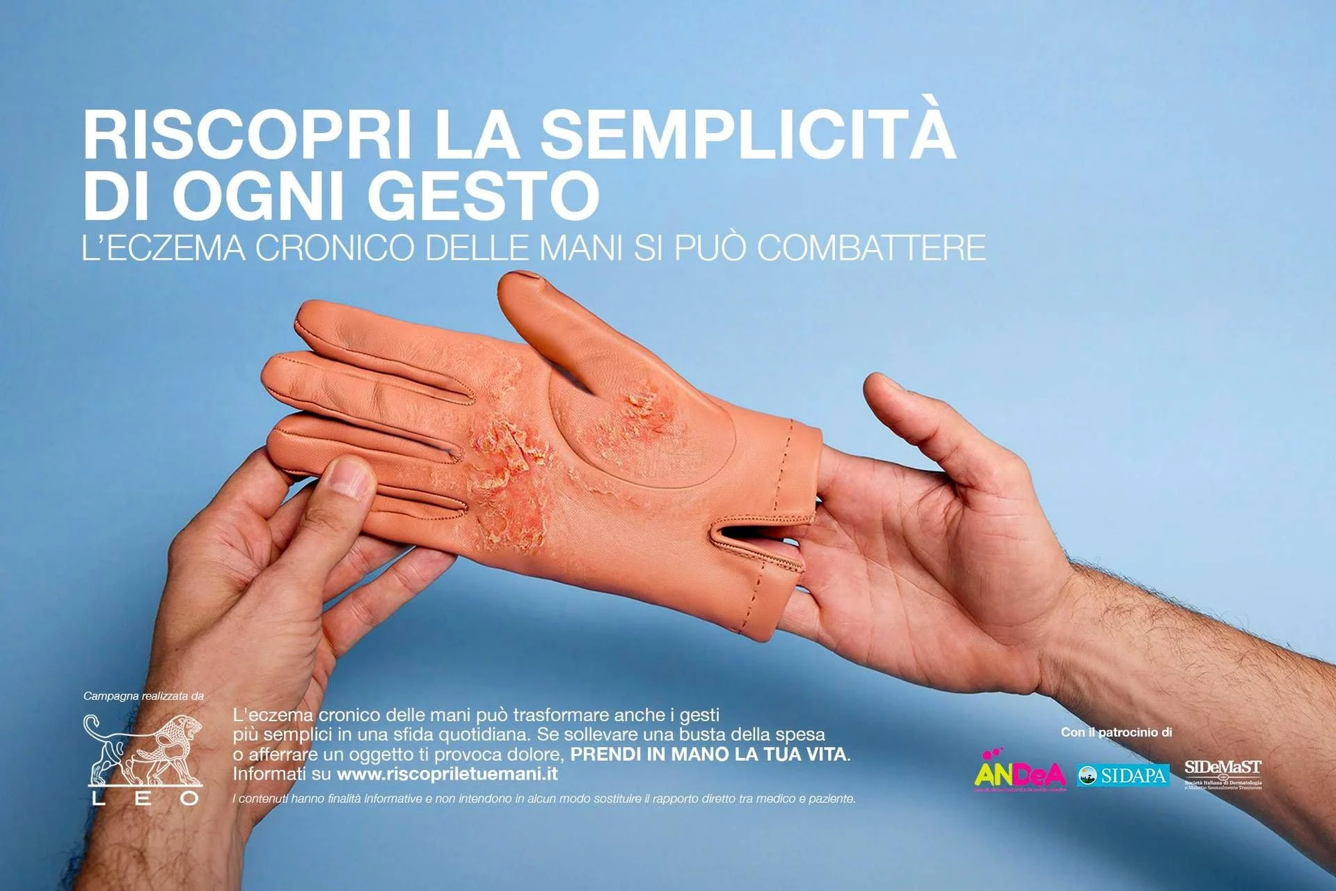 Eczema crônico nas mãos: campanha 'Prendi in mano la tua vita' alerta para dor, prurido e acesso mais rápido ao especialista
