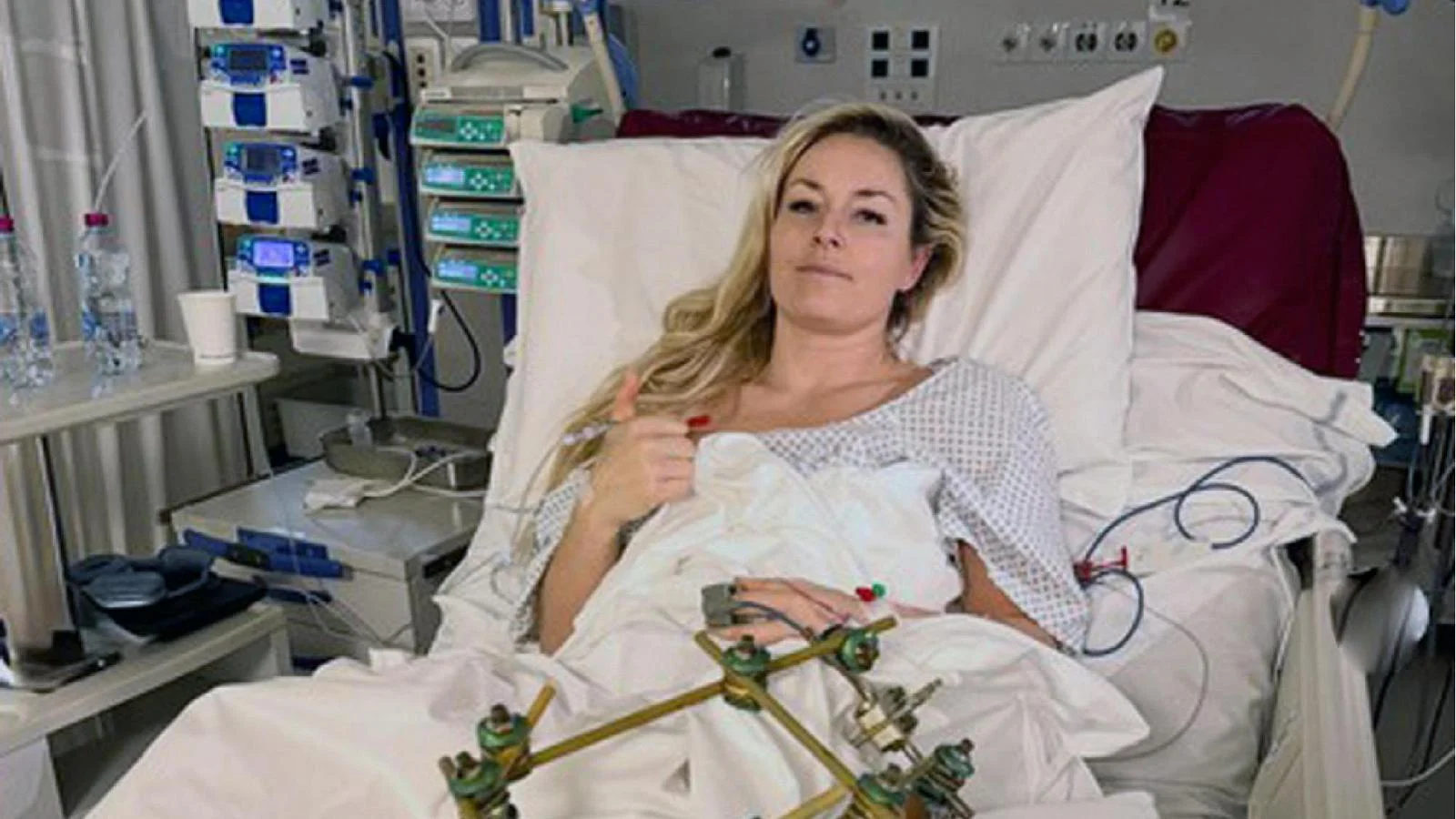 Lindsey Vonn enfrenta a quarta cirurgia após queda em Cortina: 'A estrada ainda é longa'