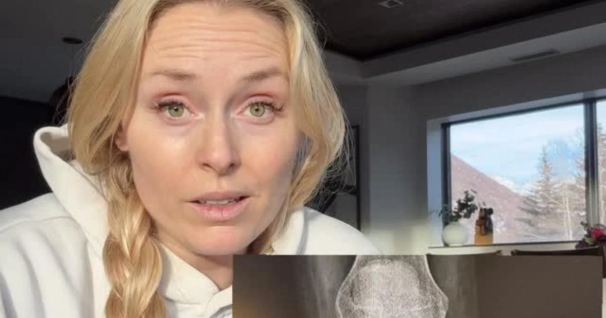 Lindsey Vonn revela: 'Risco de perder a perna; recuperação levará pelo menos um ano'