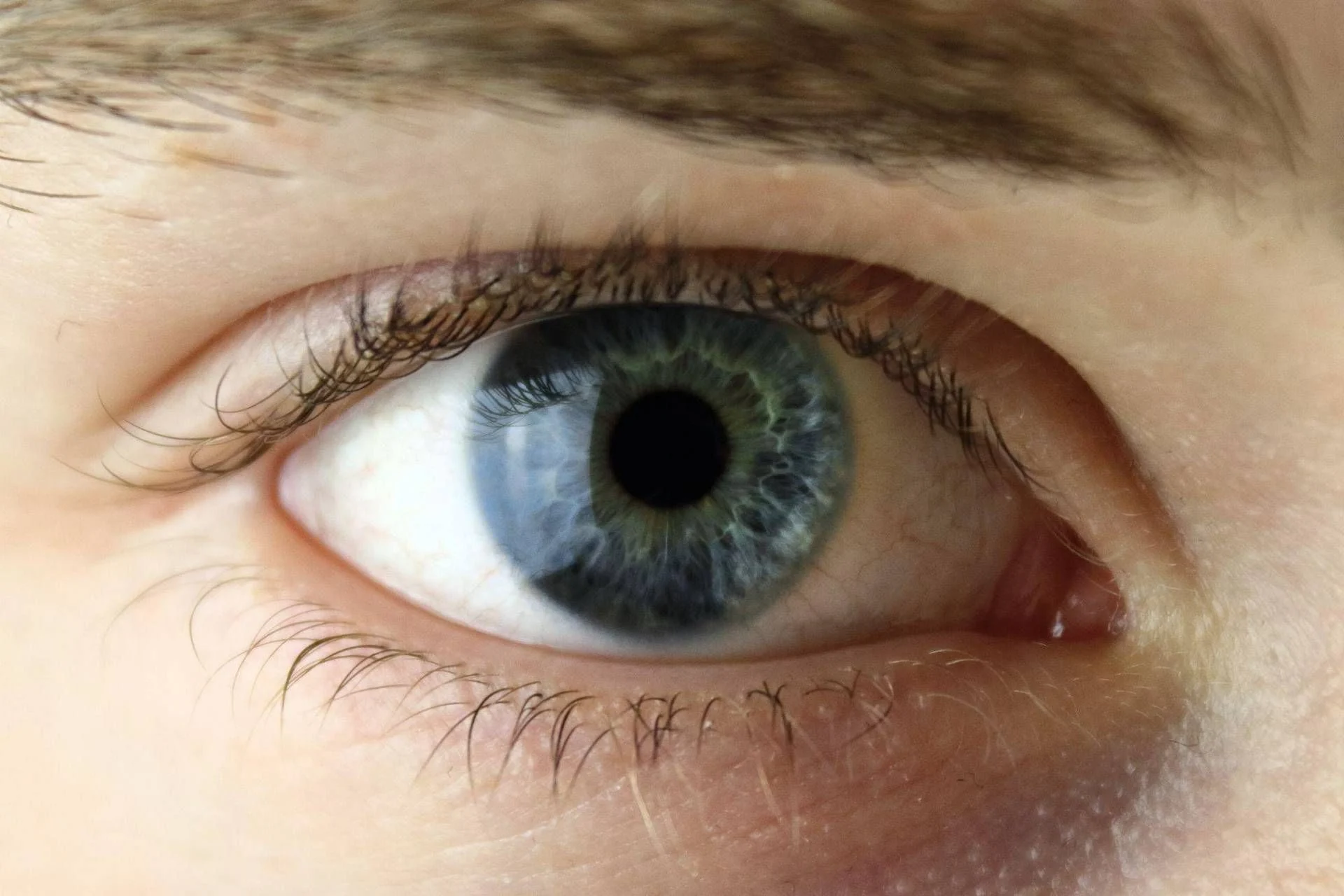 Lentes ICL: especialista Mularoni explica por que mais pacientes estão conhecendo essa alternativa ao laser