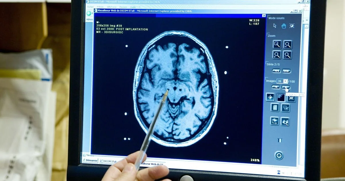 Novo atlas celular do cérebro revela pistas sobre autismo e Alzheimer