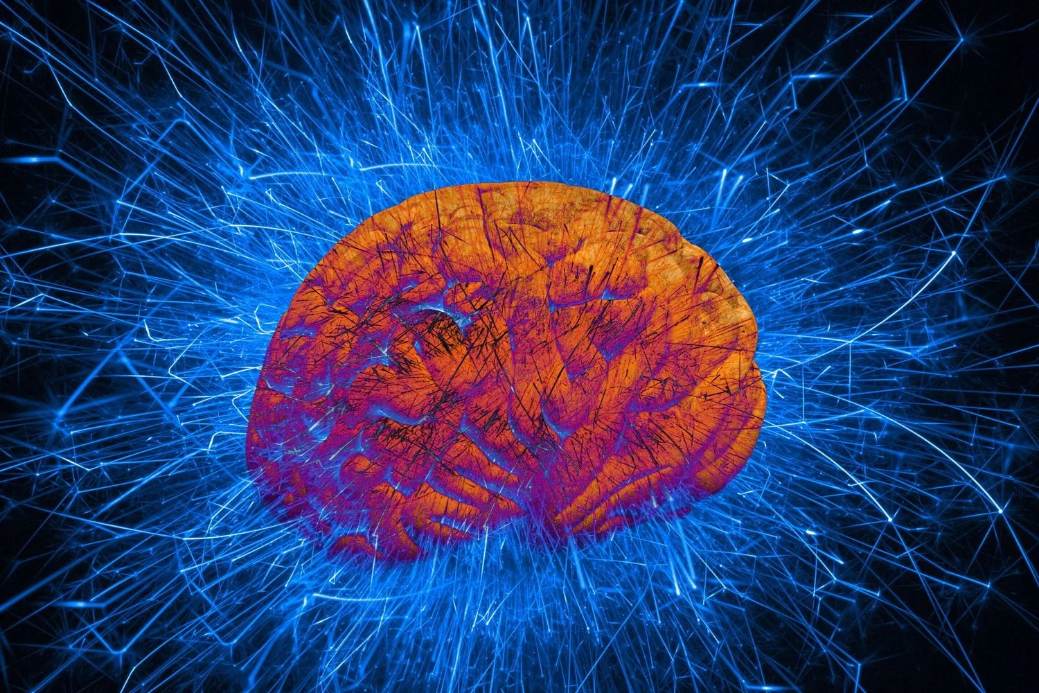 China aprova 'Neo', primeiro implante cerebral para pacientes com paralisia grave