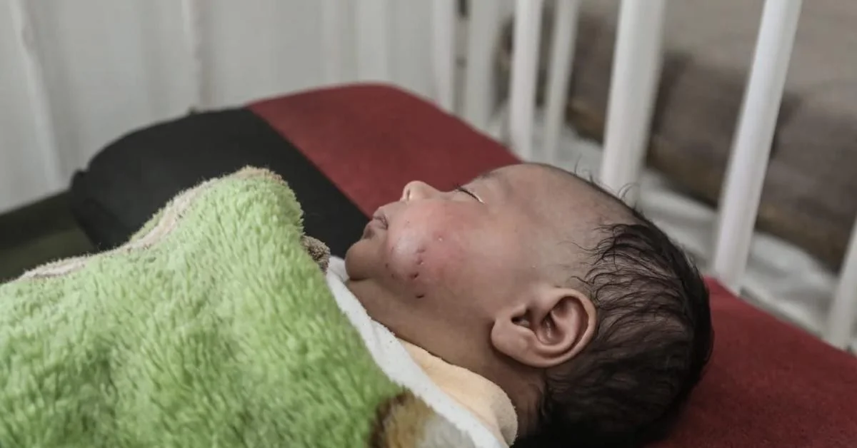 Gaza: Bebê mordido por rato revela colapso sanitário nas tendas de deslocados