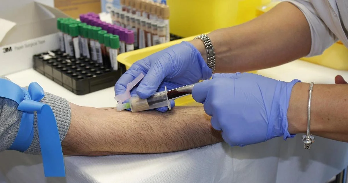 Hepatite A em Roma: 50 casos no Lazio ligados a mexilhões contaminados