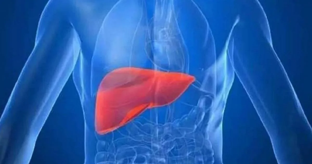 Hepatite A: o que é, como se transmite e como se proteger