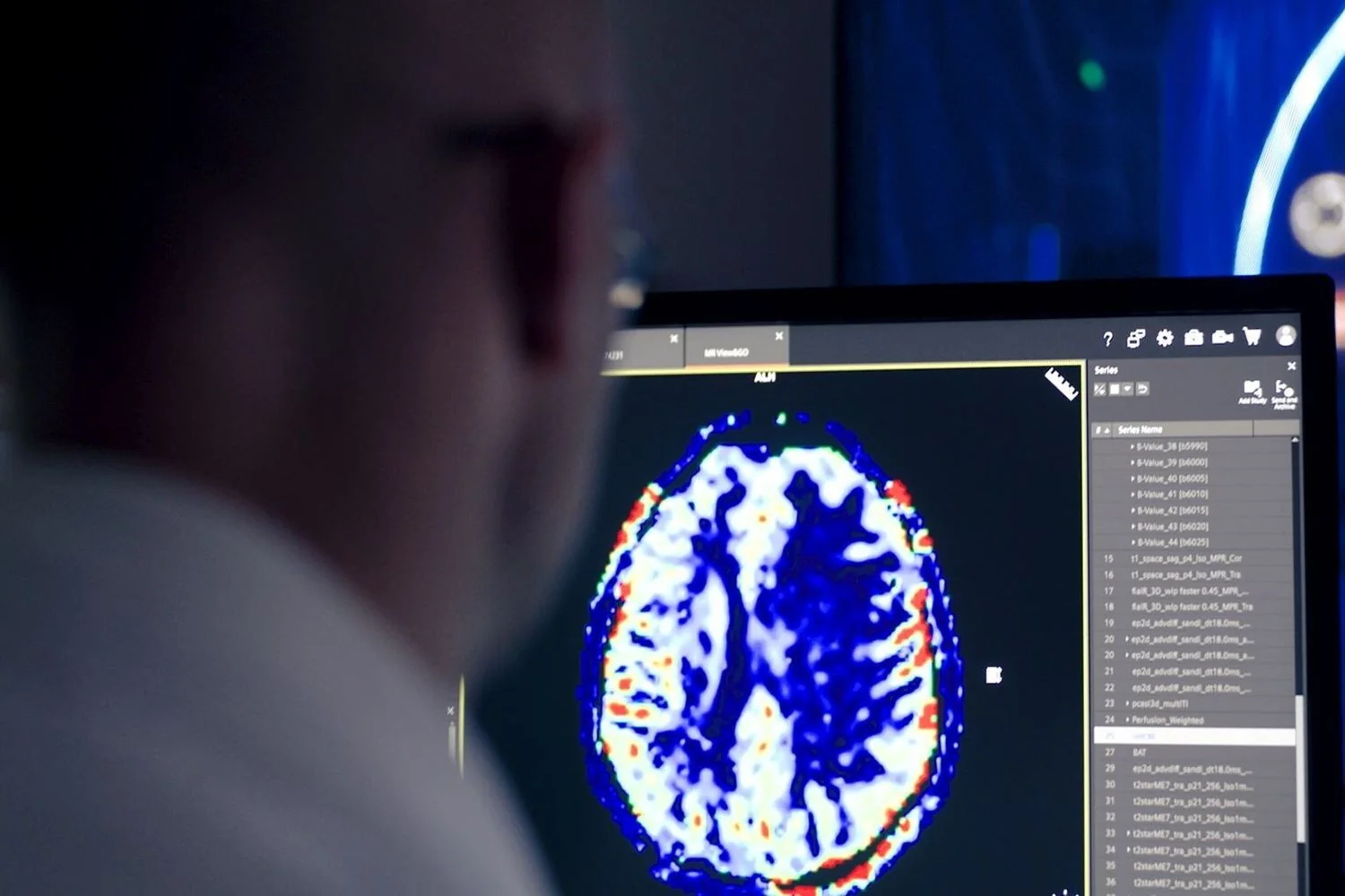 Humanitas acelera a pesquisa com Imaging avançado e IA: mais precisão, menos invasividade