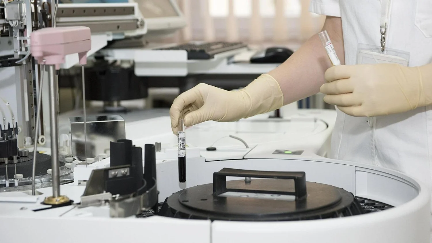 Nápoles proíbe peixe cru após surto de hepatite A: medidas, fiscalizações e impacto local