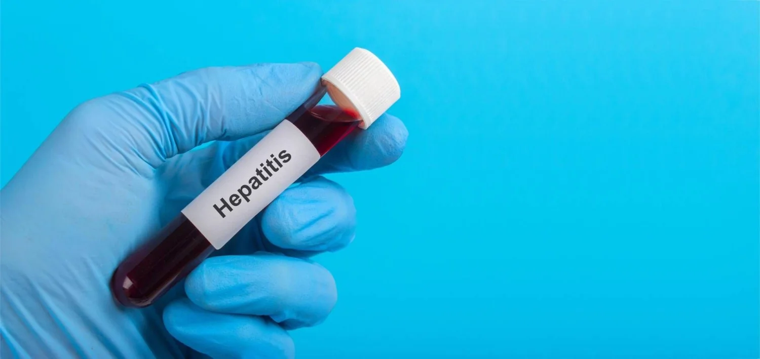 Surto de hepatite A em Nápoles: frutos do mar crus e contágio entre pessoas podem ser a ponta do iceberg