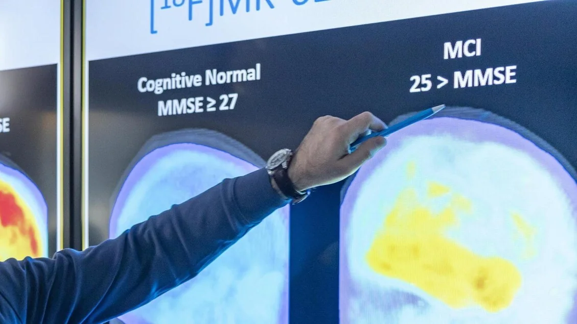 Tampão nasal promete diagnosticar Alzheimer precocemente, aponta estudo da Duke