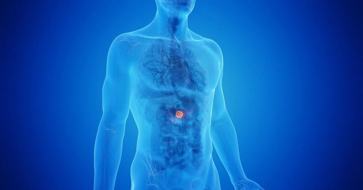 Tumor do pâncreas: sinais de alerta, desafios no diagnóstico e a urgência da prevenção