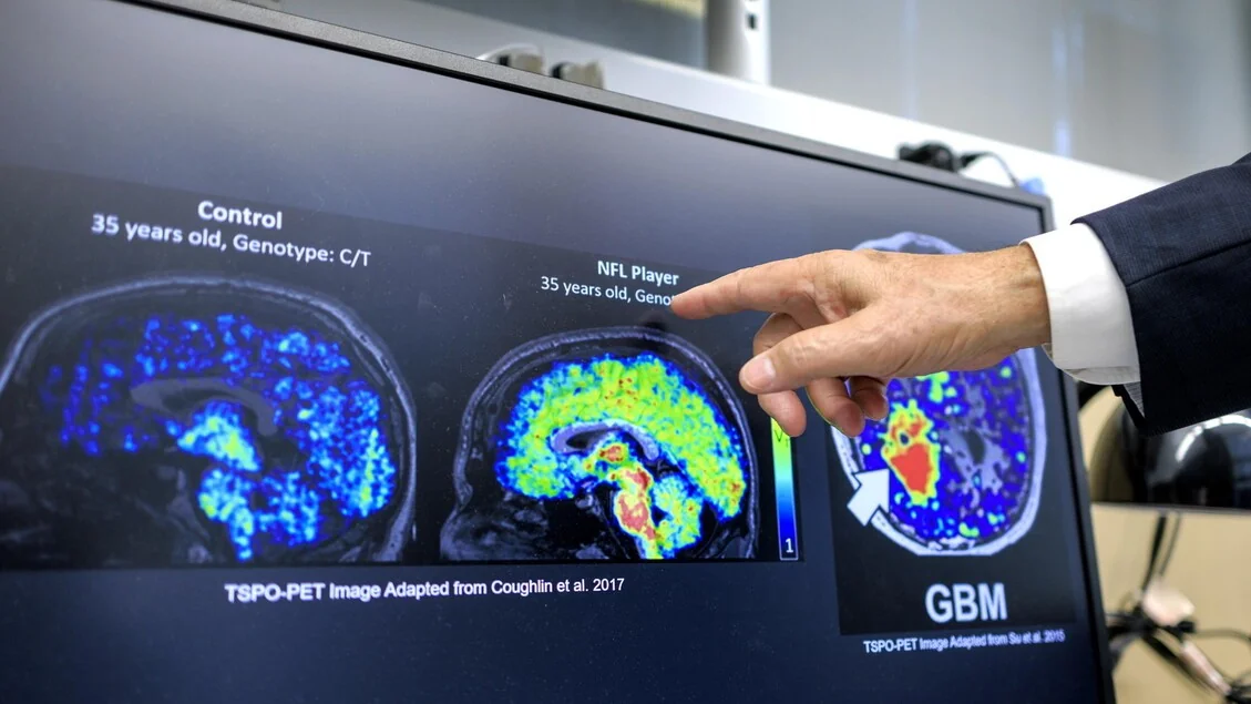 10 comportamentos essenciais para prevenir as demências, segundo relatório da Alzheimer Association 2026