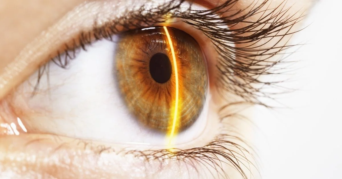 Chega Ally: laser robótico guiado por inteligência artificial que revoluciona a cirurgia de catarata em Negrar