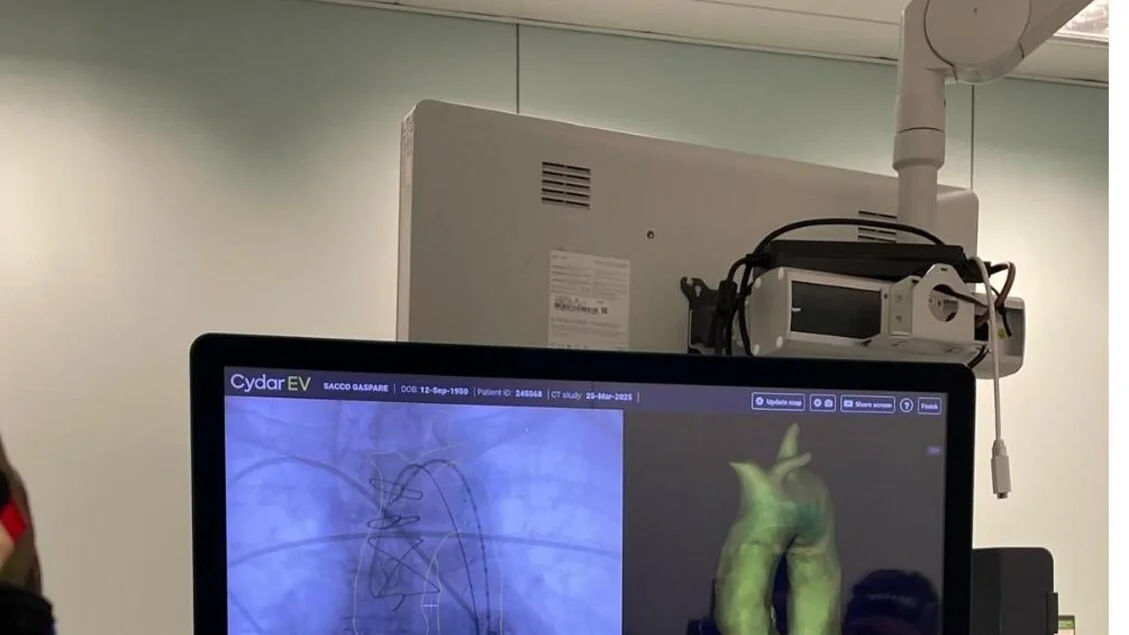 Estudos italianos identificam pacientes com alto risco de mortalidade após TAVR