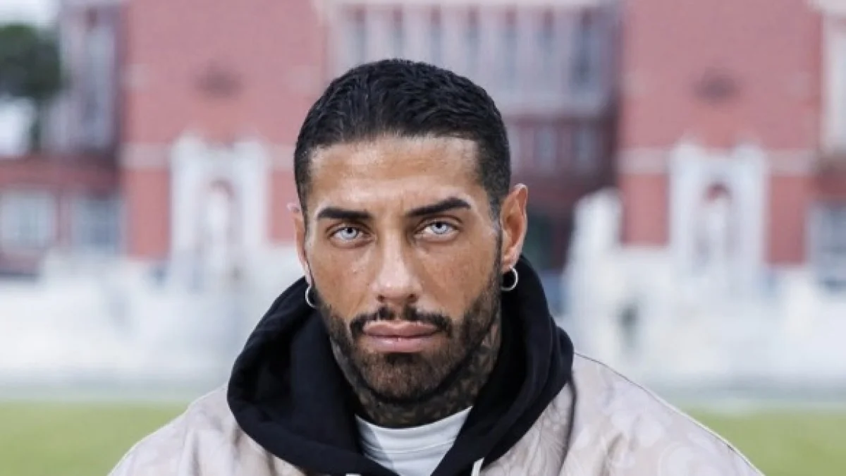 Francesco Chiofalo: de Temptation Island ao tumor no cérebro e à polêmica mudança da cor dos olhos