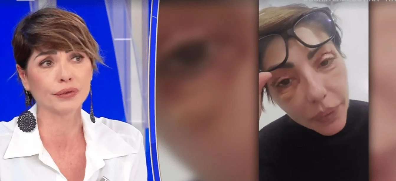 Ilaria Galassi revela blefaroplastia e enfrenta onda de insultos nas redes: ofensas também atingiram seus filhos