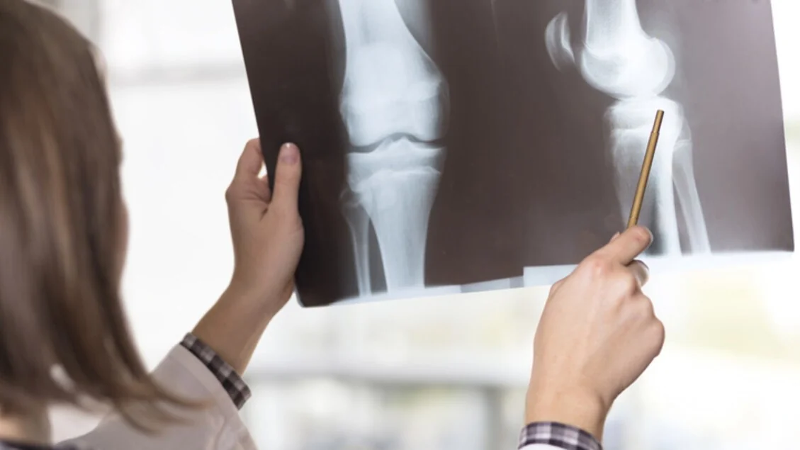 Medicina de urgência: em 2 de 3 casos a imagem diagnóstica é determinante