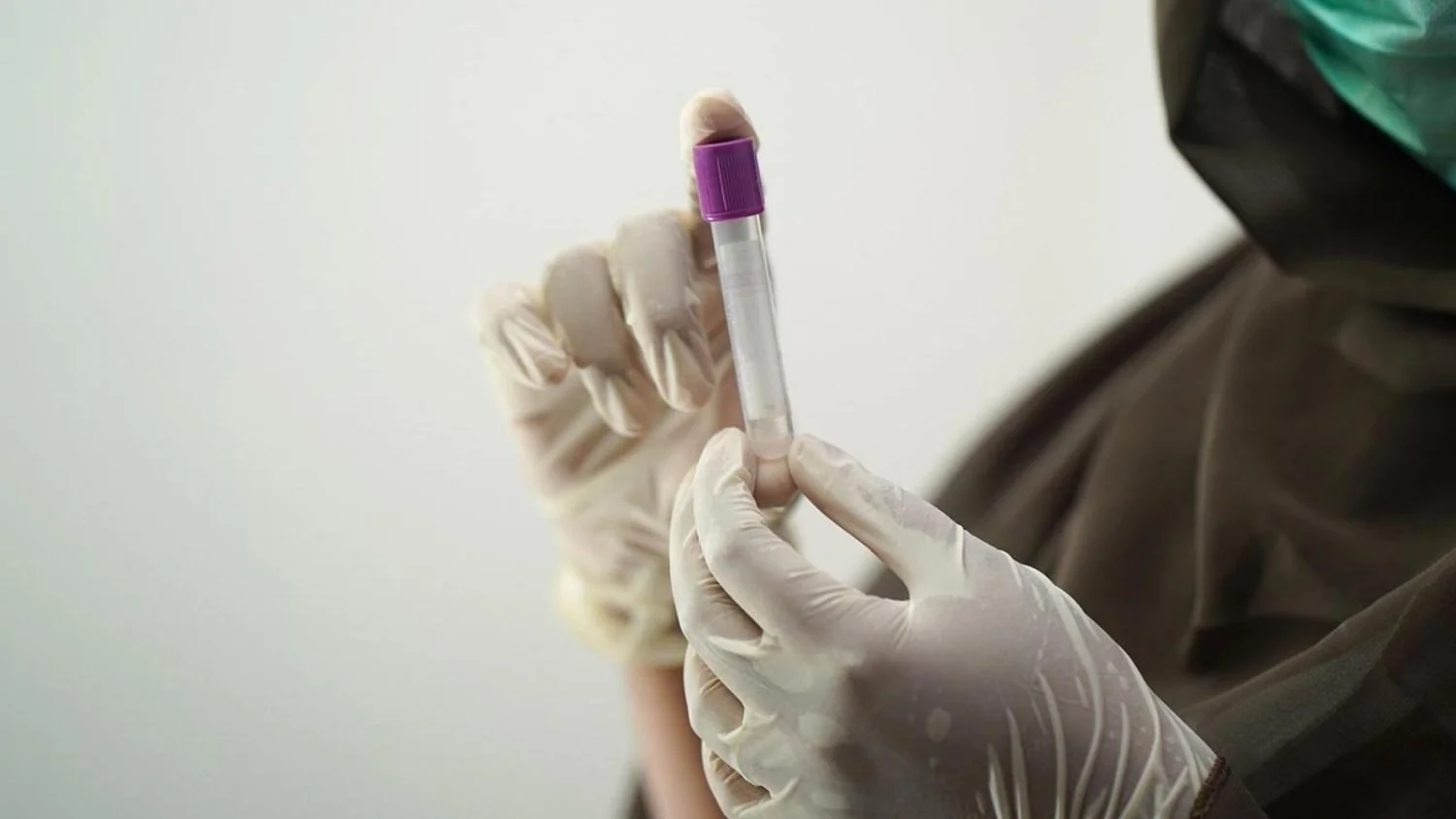 ASL Pescara pede calma após dois casos de meningite: evitar alarmismos sobre a palestra 'Audacia'