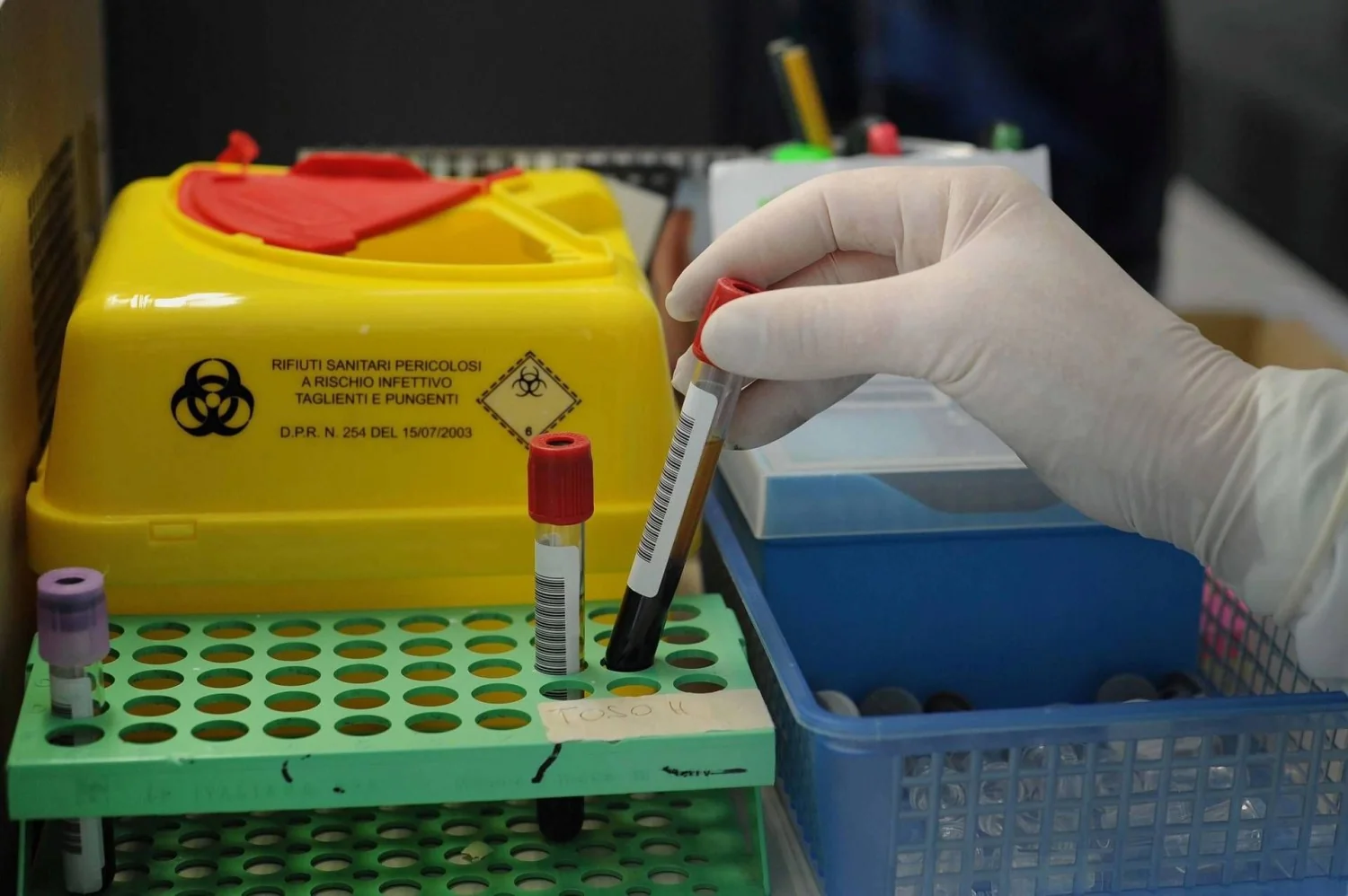 MethylScan: teste de sangue 'low cost' da UCLA promete detectar vários tipos de câncer e lesões orgânicas