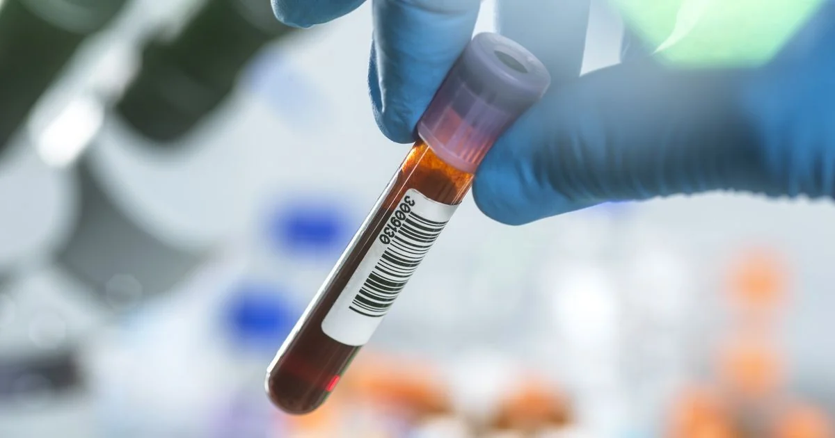 MethylScan: novo teste de sangue low cost detecta múltiplos tumores com alta precisão