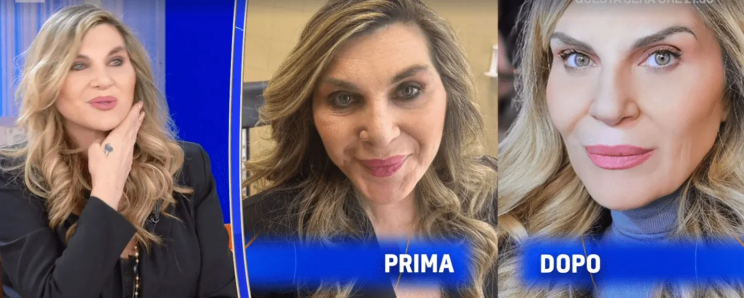 Nadia Rinaldi e o drama após a cirurgia: “Vivi um ano e meio sem seios”