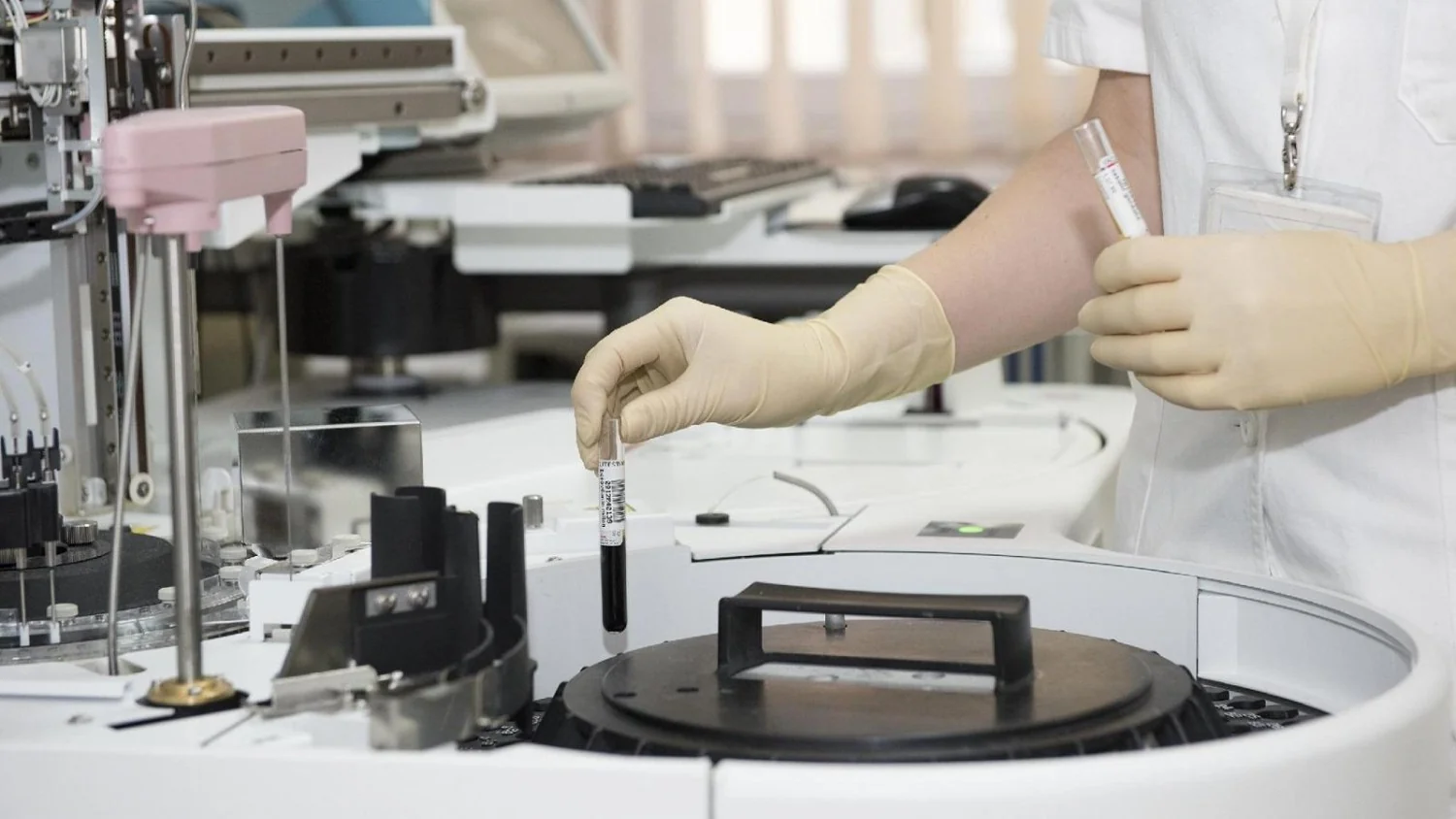 Novo teste de sangue low cost detecta múltiplas doenças por metilação do DNA