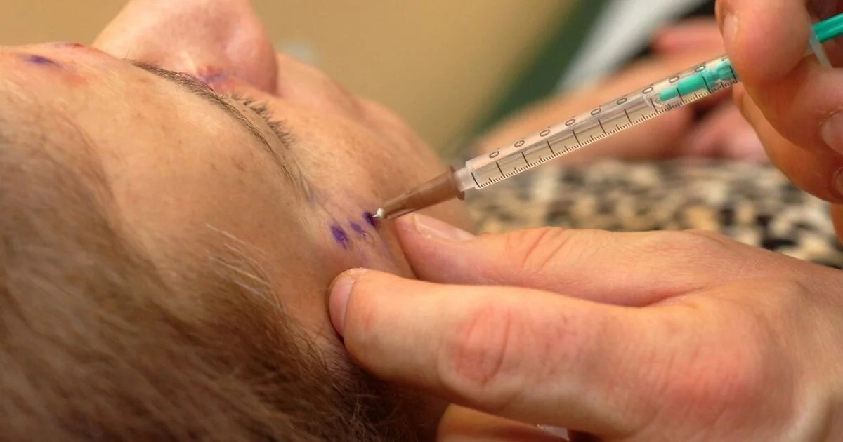 Homens impulsionam boom da medicina estética: como o Brotox e os protocolos sob medida estão mudando o mercado