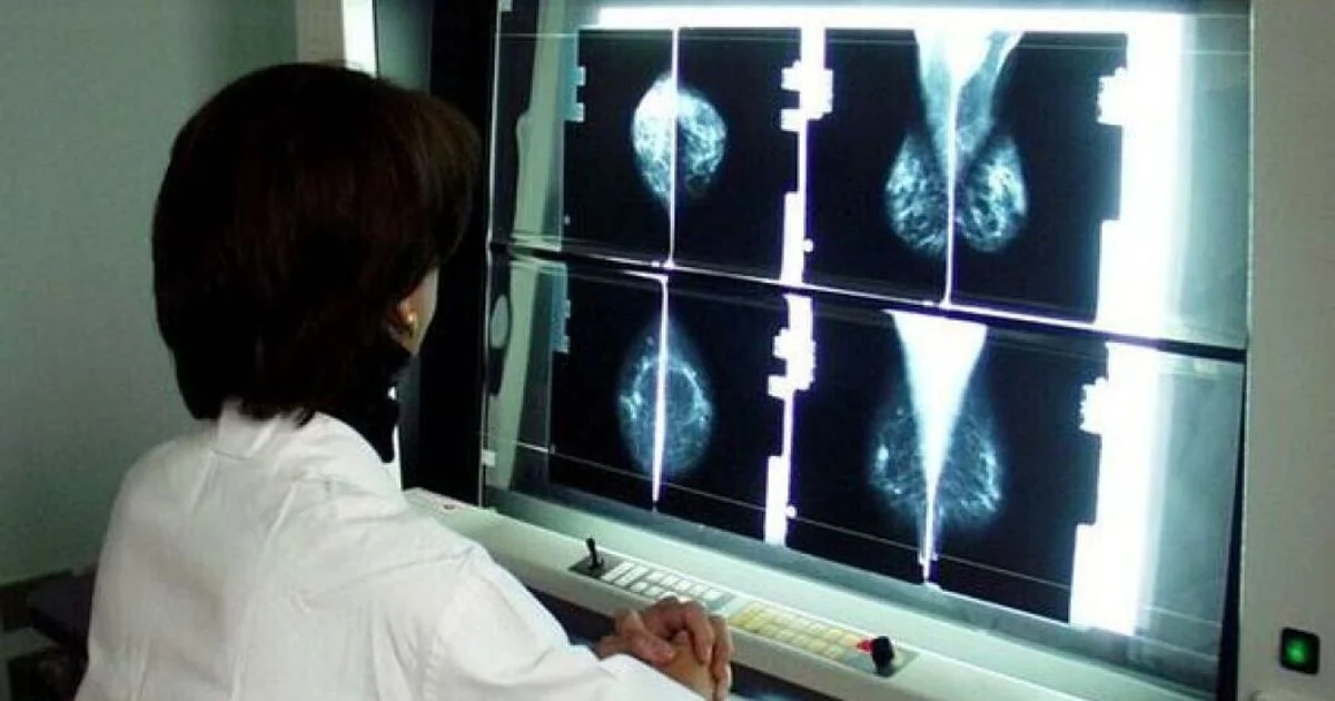 Remissão inesperada de mixofibrosarcoma após biópsia nos EUA: caso raro investigado