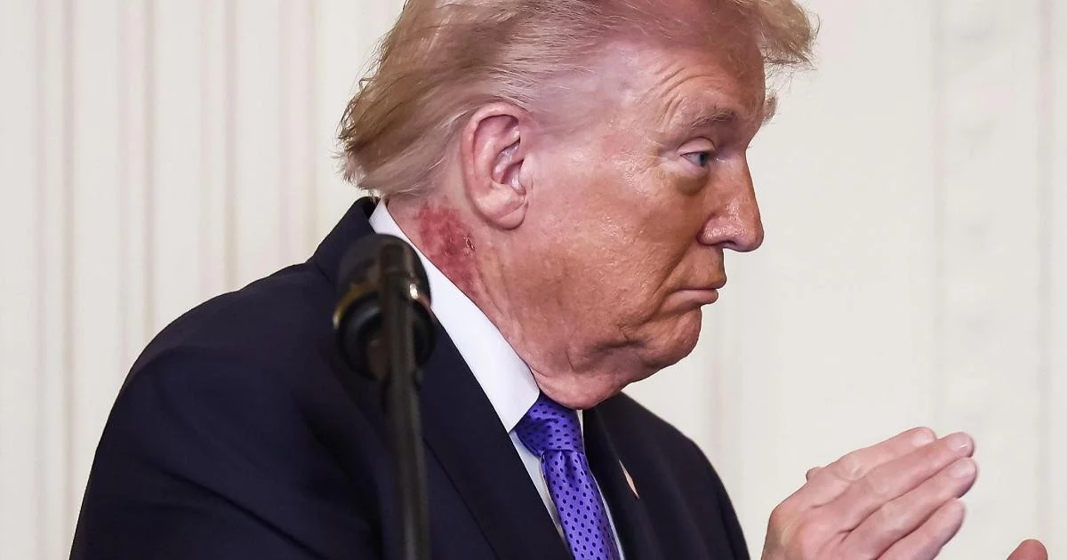 Saúde de Trump volta ao centro do tabuleiro: novos exames esta semana no Walter Reed