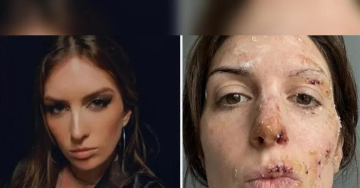 Sobrevivente Eleonora Palmieri exige respeito às vítimas enquanto família Moretti planeja reabertura