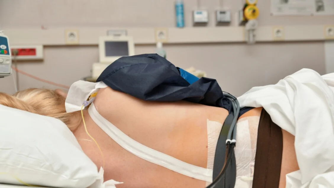 Estudo de Aosta: a epidural no trabalho de parto não eleva o risco de parto cesáreo