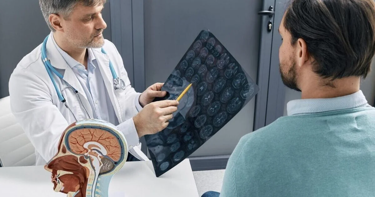 Estimulação elétrica cervical epidural melhora força e mobilidade do braço após ictus, mostra estudo