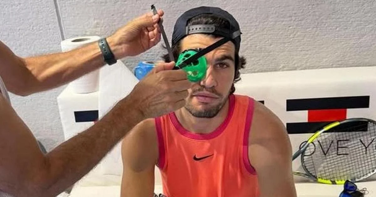 Por que Carlos Alcaraz treina com um cone no olho antes de voltar ao Masters 1000 de Cincinnati