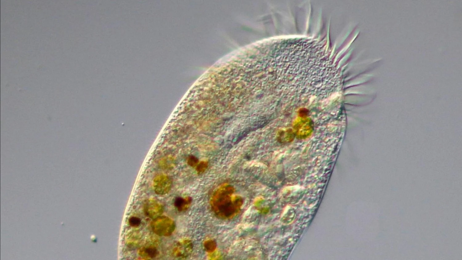 Menina de 8 anos morre após banho no Lago Claiborne; ameba Naegleria fowleri é apontada