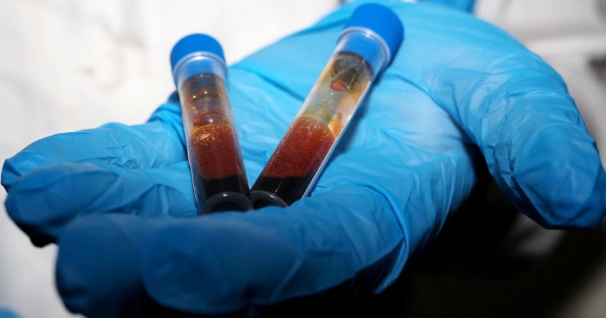 Dispositivo com IA permite fazer análises do sangue em casa e acompanhar tratamentos à distância