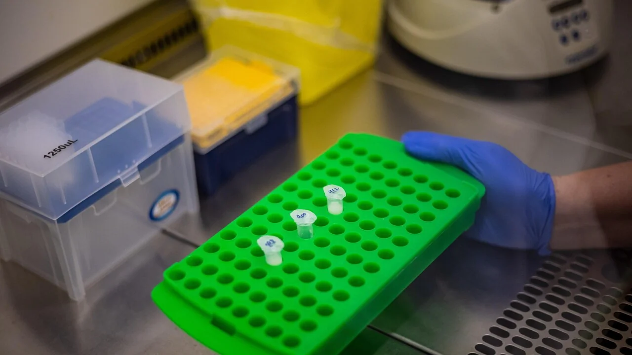UE envia testes PCR à OMS por €2,1 milhões para combater surto de Ebola Bundibugyo
