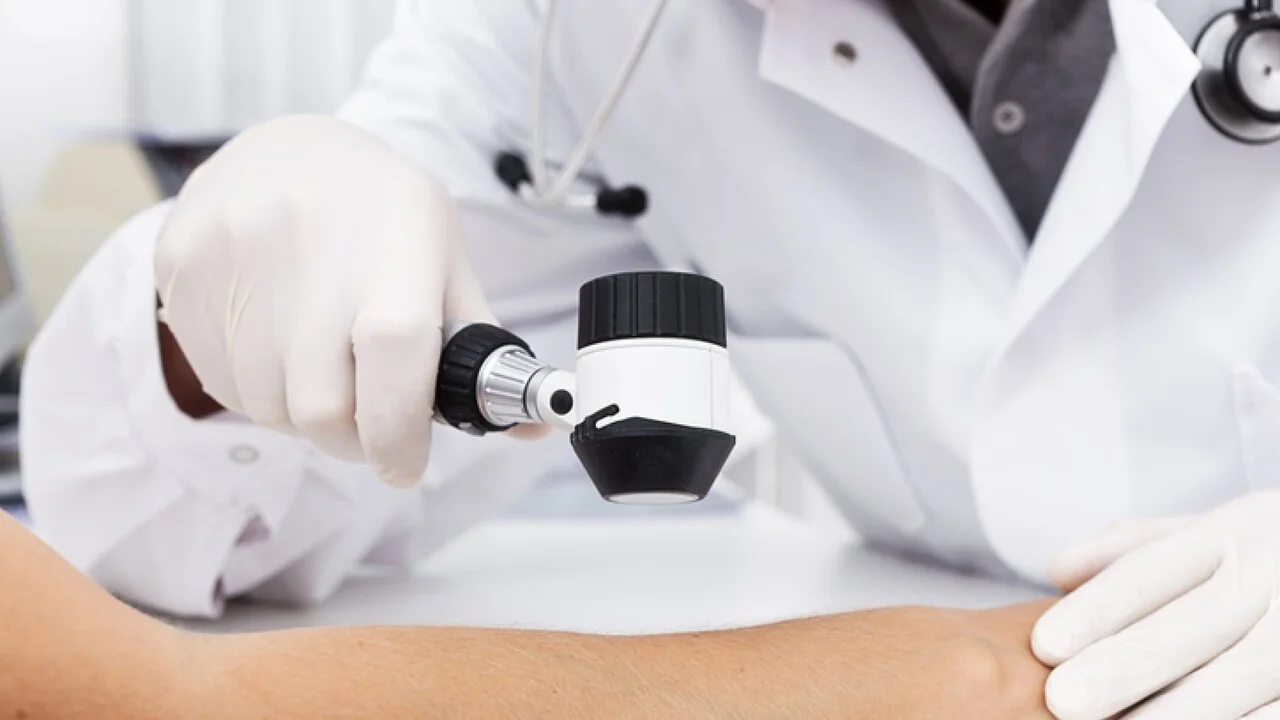 Vacina experimental contra o melanoma apresenta resultados promissores; Moderna dispara +130%