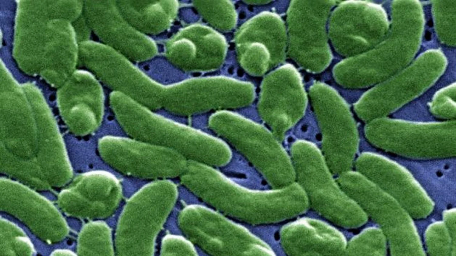 Vibrio vulnificus detectado no Estreito de Messina: ISS garante risco muito baixo para a Itália