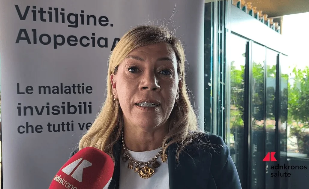 AbbVie pede reconhecimento de vitiligo e alopecia areata pelo SSN após evidência de impacto socioeconômico