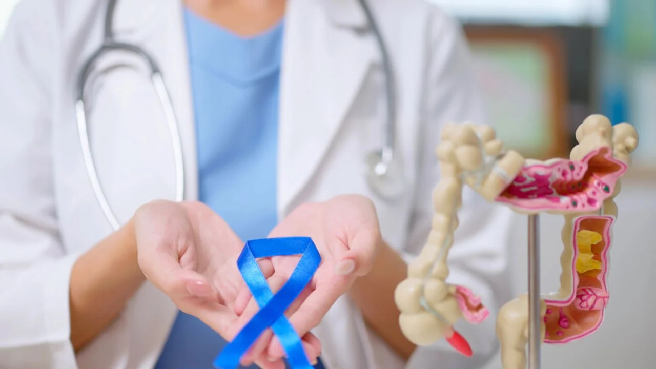 Biopsia líquida após cirurgia do cólon ajuda a prever risco de recidiva e a ajustar quimioterapia, diz estudo Pegasus