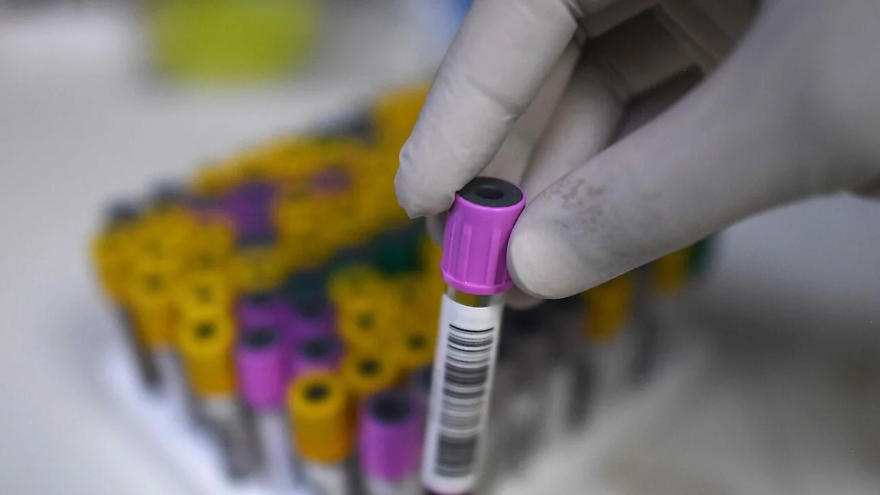 Glofitamab com GemOx: nova opção reembolsada na Itália para linfoma DLBCL em segunda linha