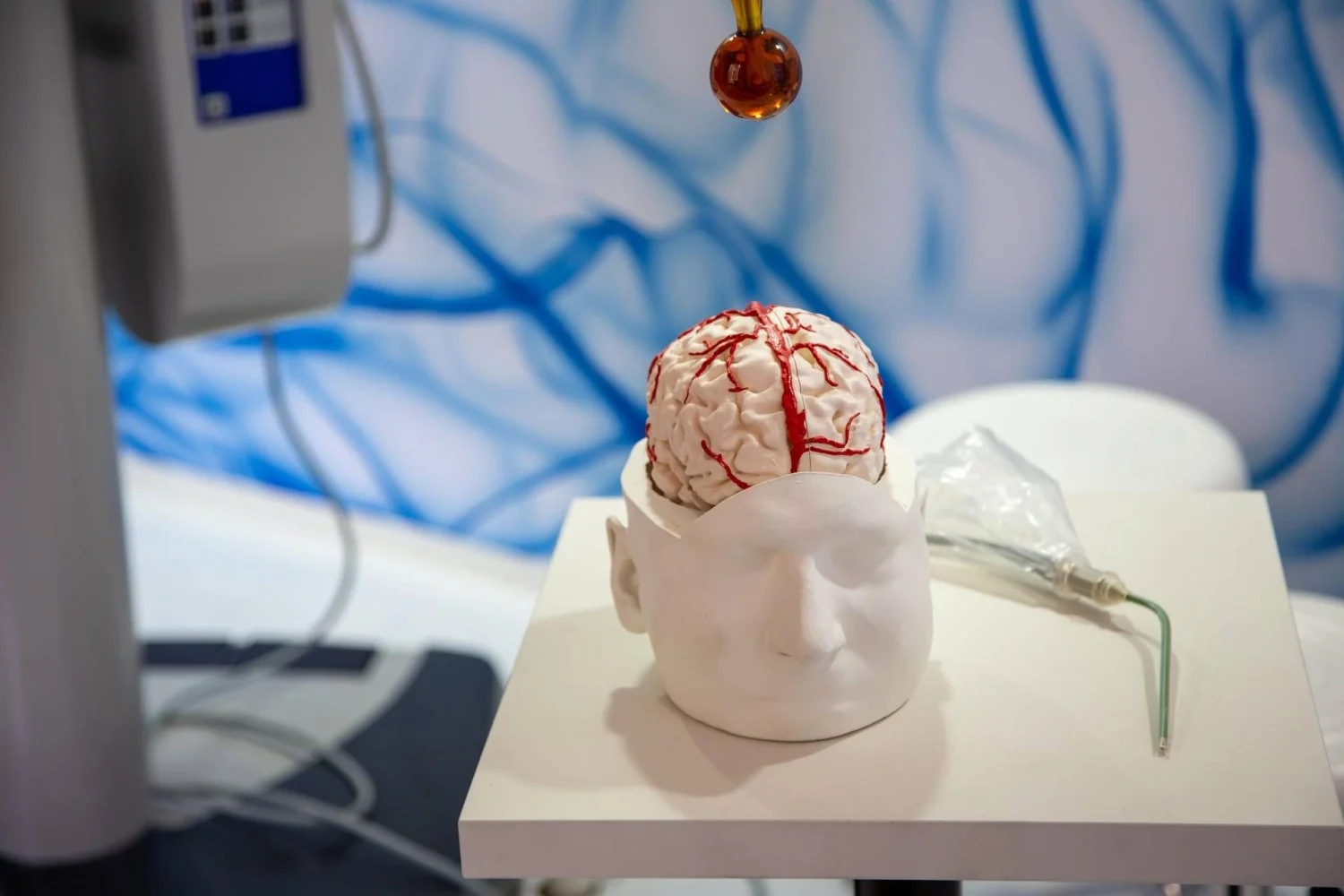 Da gliomas ao Parkinson: como a inteligência artificial já está transformando a neurocirurgia