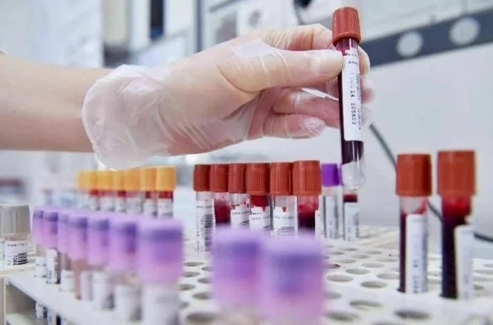Ema recomenda aprovação do ocrelizumab para esclerose múltipla recidivante a partir dos 10 anos