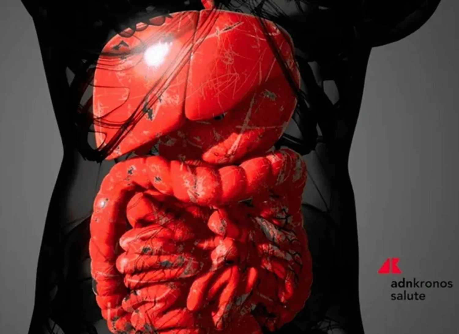 Aifa aprova reembolso de mirikizumab para tratamento da doença de Crohn em adultos