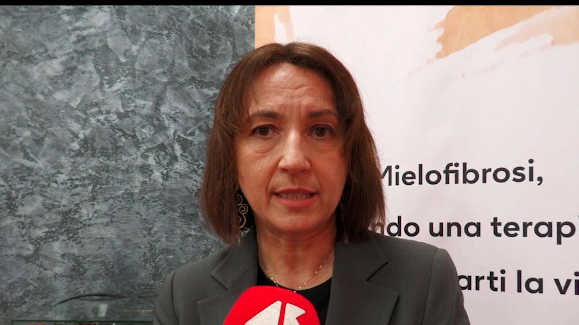 Momelotinib reduz dependência de transfusões e melhora anemia na mielofibrose, diz GSK