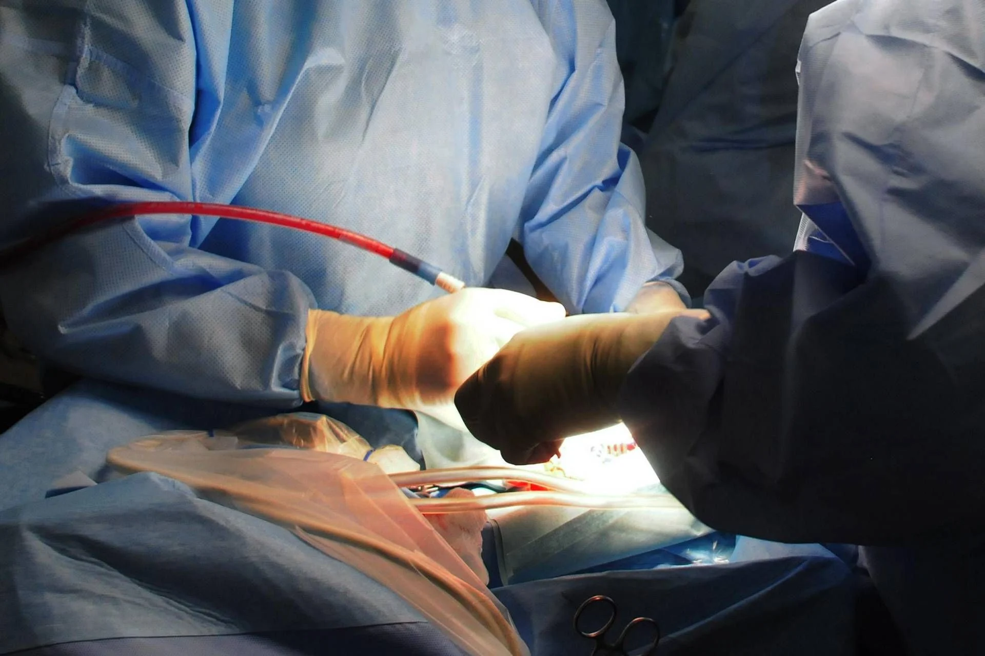 Padova realiza primeiro transplante de fígado totalmente robótico com órgão em máquina de perfusão